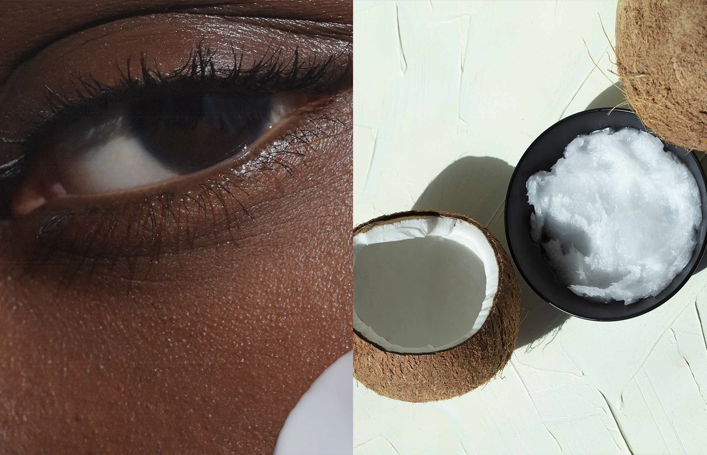 model with coconut oil under her eye demonstrating how to use coconut oil on your skin