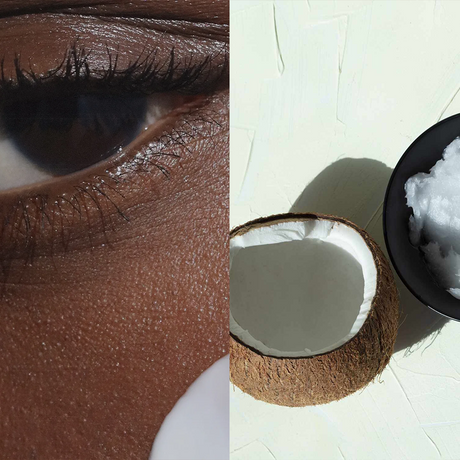 model with coconut oil under her eye demonstrating how to use coconut oil on your skin