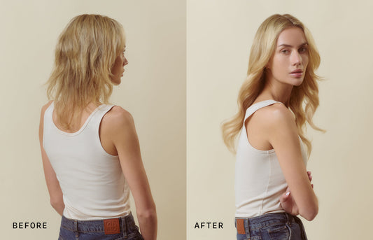 The Real Reason Your Hair Is Thinning—And What To Do About It