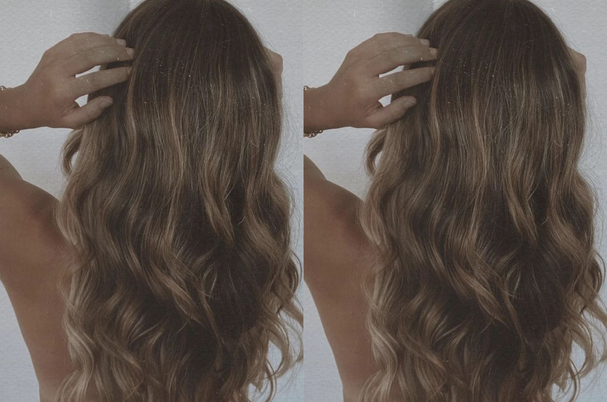 Scalp Bacteria: Is It Good or Bad For Hair Growth?