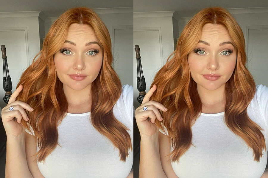 How to Get Rid of Itchy Scalp Your Path to Comfort