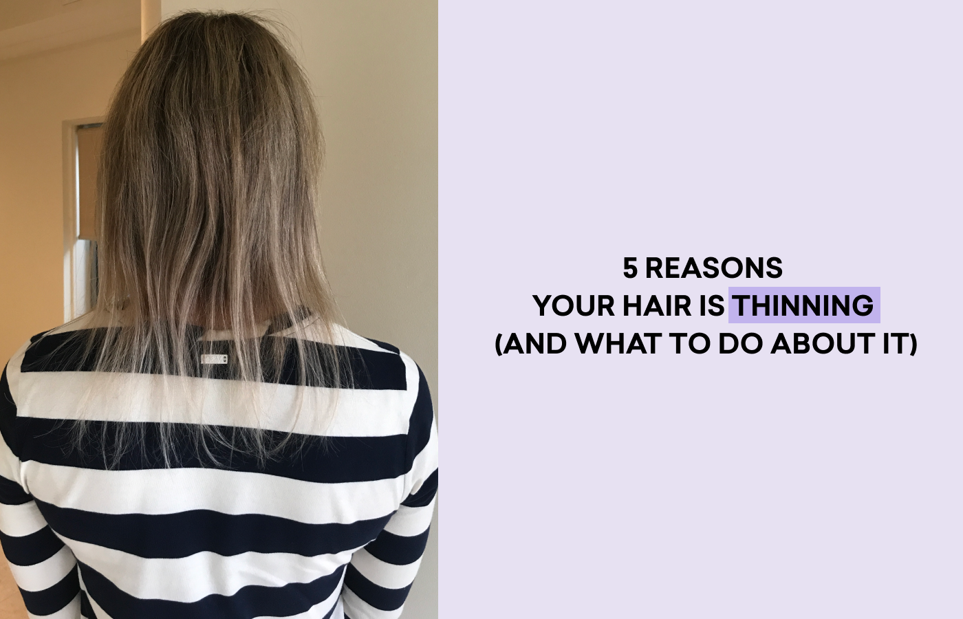 5 Reasons Your Hair Is Thinning (And What To Do About It)